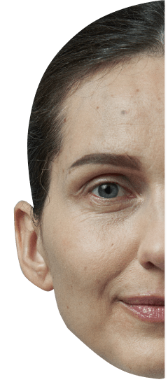 Groundbreaking accuracy in facial diagnostics